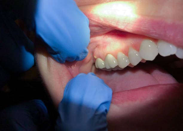 Best Emergency Treatment for Jaw Pain or Injury in Redding, CA