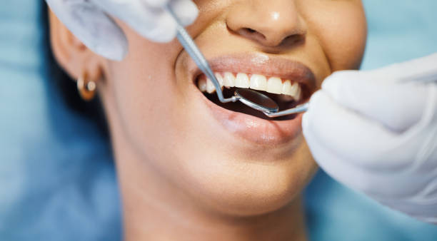Best Emergency Denture Repair in Redding, CA
